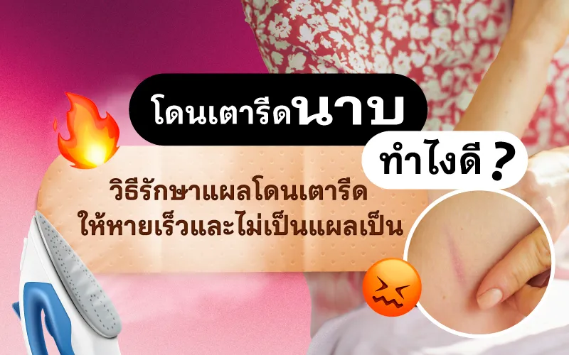 โดนเตารีดนาบทำไงดี? วิธีรักษาแผลโดนเตารีดให้หายเร็วและไม่เป็นแผลเป็น